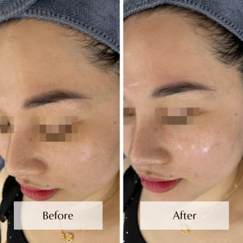 Liệu Trình Bio Phyto (1)