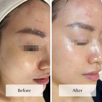 Liệu trình Bio Phyto (2)